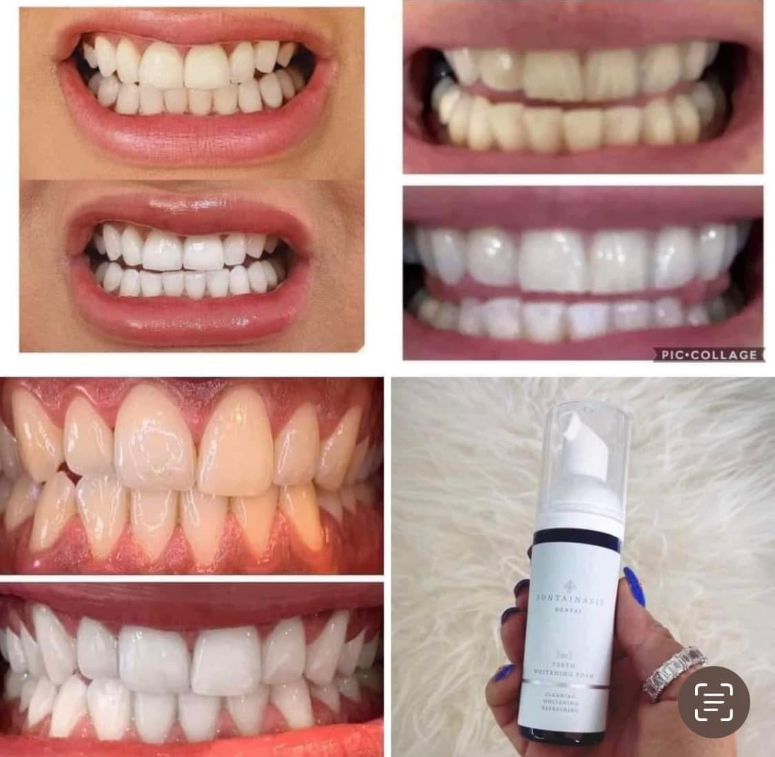 Teeth Whitening Foam 3 in 1